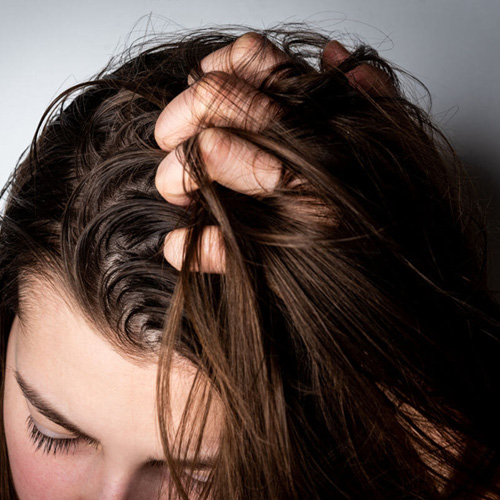 Ragazza bruna con una mano tra i capelli sporchi dall'aspetto molto trascurato.