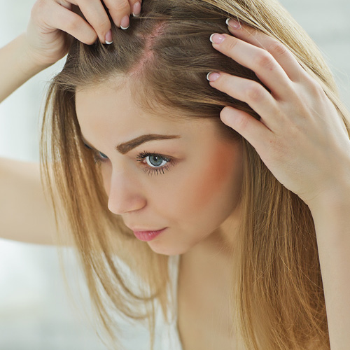 Ragazza che si guarda allo specchio una parte di cuoio capelluto arrossato